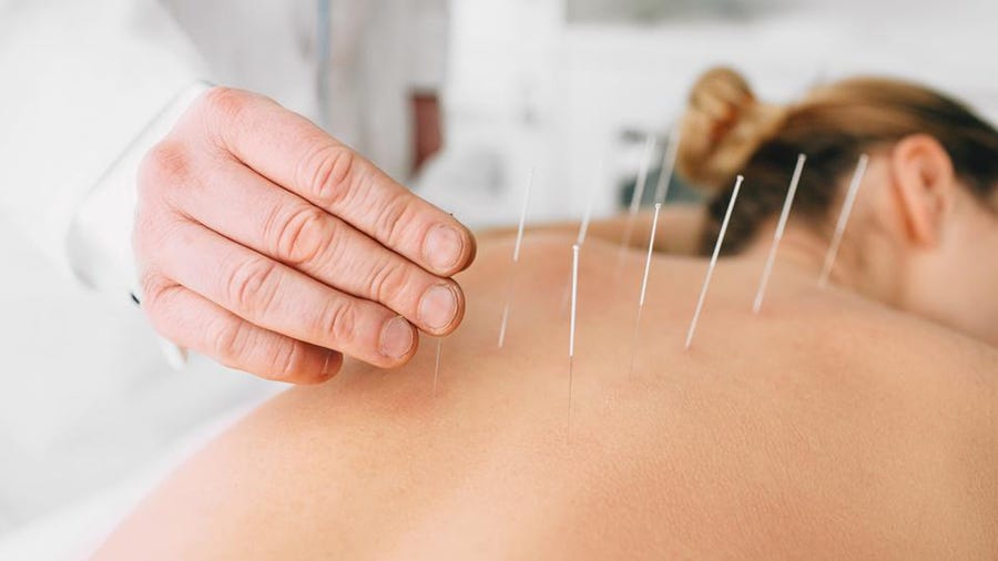 We Offer The Best Acupuncture in Portland, OR