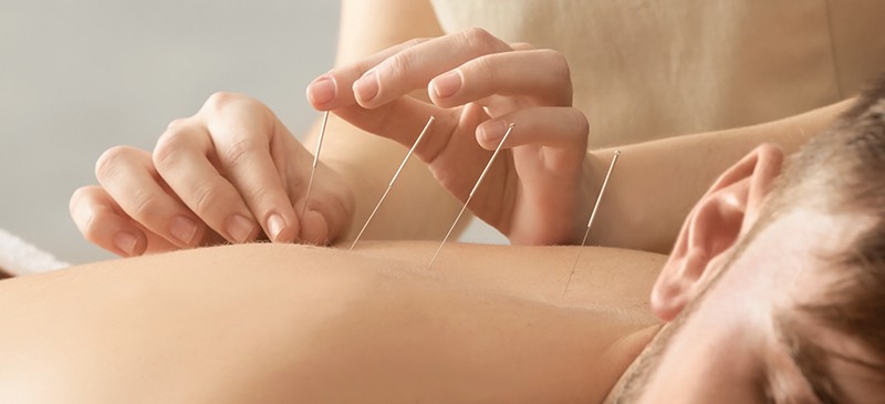 Acupuncture in Portland